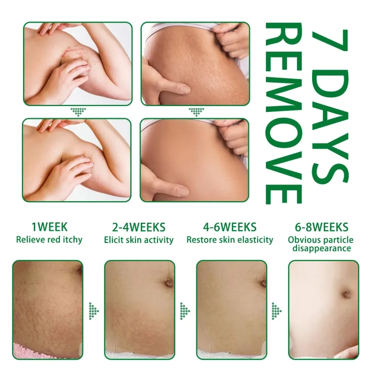 Jaysuing 7days remove - Gallery 3